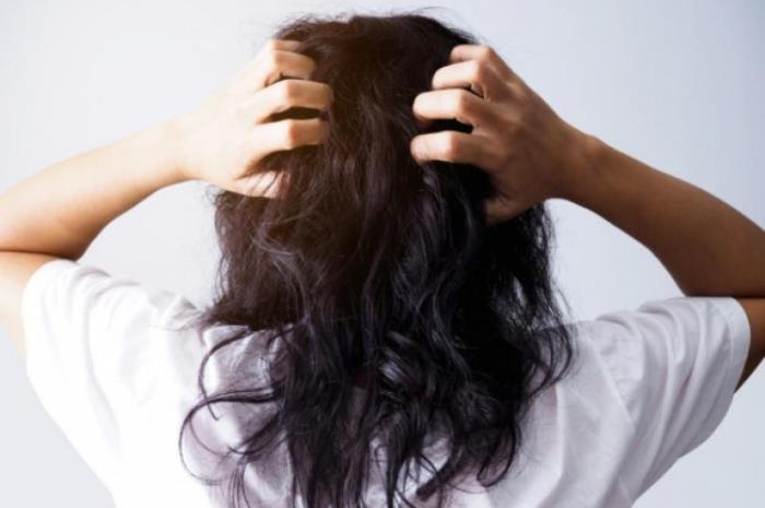 Cara Mengatasi Rambut Kering, Tips untuk Merawat Rambut Agar Tetap Sehat